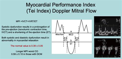 lv mpi|Myocardial Performance Index (Tei Index): A simple tool to .